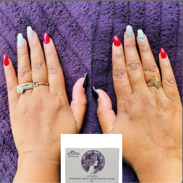 Before and after hands side by side